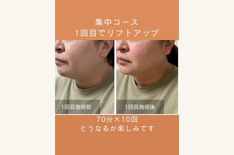 ◎Instagram投稿テンプレート_2_旅行のコピーのコピーのコピー.zip - 2