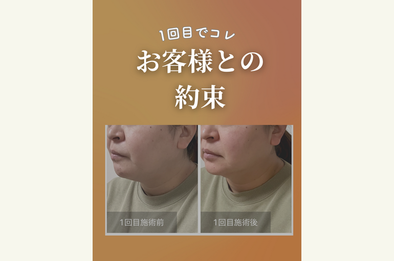 122のコピーのコピー.zip - 1