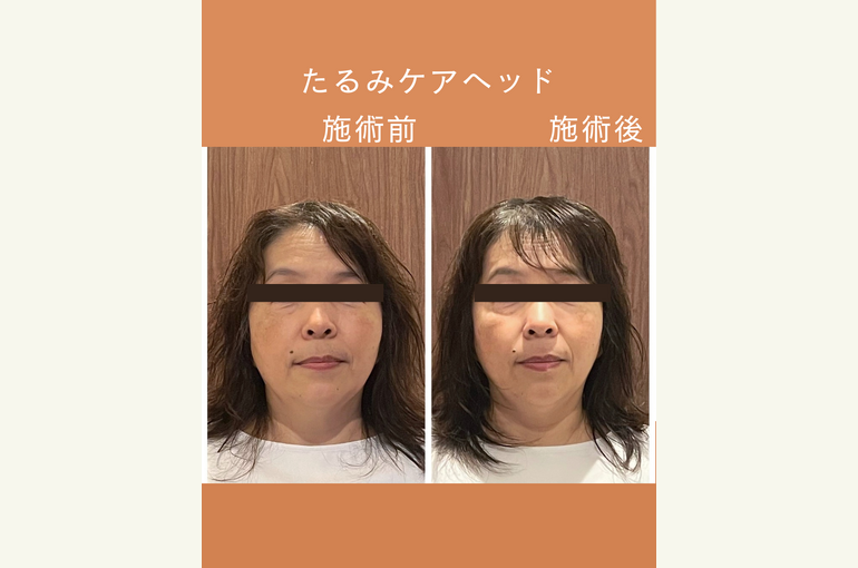 ◎Instagram投稿テンプレート_2_旅行のコピーのコピーのコピー.zip - 1