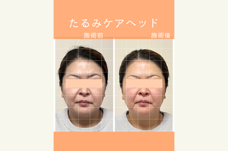 ◎Instagram投稿テンプレート_2_旅行のコピーのコピーのコピー.zip - 1